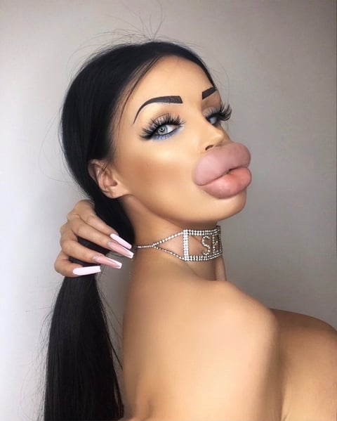  face fillers and big silicone implants. I am v...